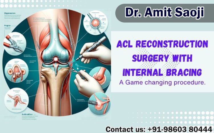 ACL surgery with internal bracing – A game changing procedure.